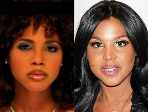 Toni Braxton before and after plastic surgery (31)