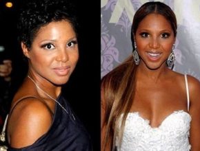 Toni Braxton before and after plastic surgery (32)