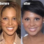 Toni Braxton before and after plastic surgery (33)