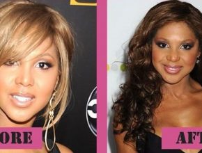 Toni Braxton before and after plastic surgery (34)