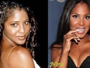 Toni Braxton before and after plastic surgery