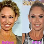 Kym Johnson before and after plastic surgery (18)