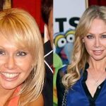 Kym Johnson before and after plastic surgery (19)