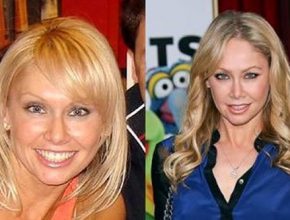 Kym Johnson before and after plastic surgery (19)