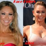 Kym Johnson before and after plastic surgery (20)