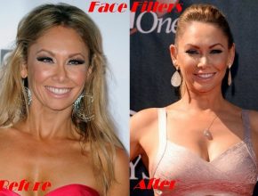 Kym Johnson before and after plastic surgery (20)