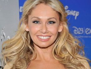 Kym Johnson plastic surgery (10)