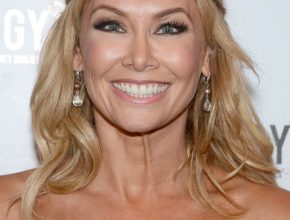 Kym Johnson plastic surgery (13)