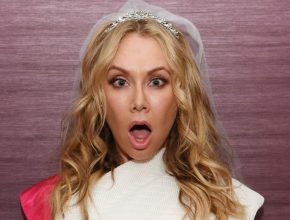 Kym Johnson plastic surgery (2)