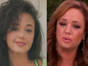 Leah Remini before and after plastic surgery