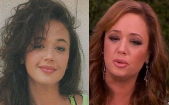 Leah Remini before and after plastic surgery