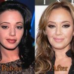 Leah Remini before and after plastic surgery (23)