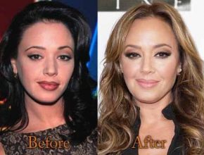 Leah Remini before and after plastic surgery (23)