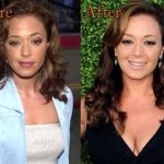 Leah Remini plastic surgery (24)