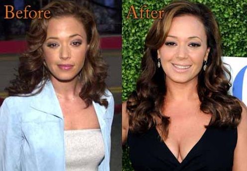 Leah Remini plastic surgery (24) .