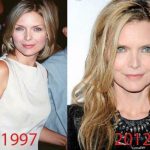 Michelle Pfeiffer before and after plastic surgery (29)