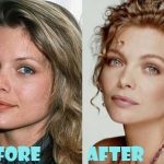 Michelle Pfeiffer before and after plastic surgery (30)