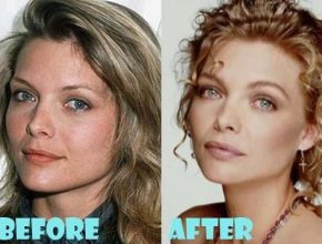 Michelle Pfeiffer before and after plastic surgery (30)