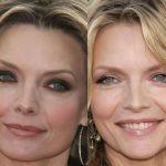Michelle Pfeiffer before and after plastic surgery (31)