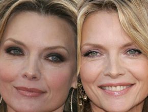 Michelle Pfeiffer before and after plastic surgery (31)
