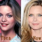 Michelle Pfeiffer before and after plastic surgery (33)