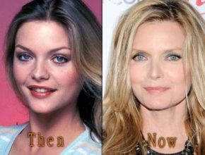 Michelle Pfeiffer before and after plastic surgery (33)