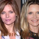 Michelle Pfeiffer before and after plastic surgery (38)