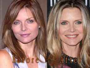 Michelle Pfeiffer before and after plastic surgery (38)