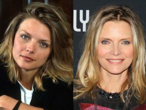 Michelle Pfeiffer before and after plastic surgery