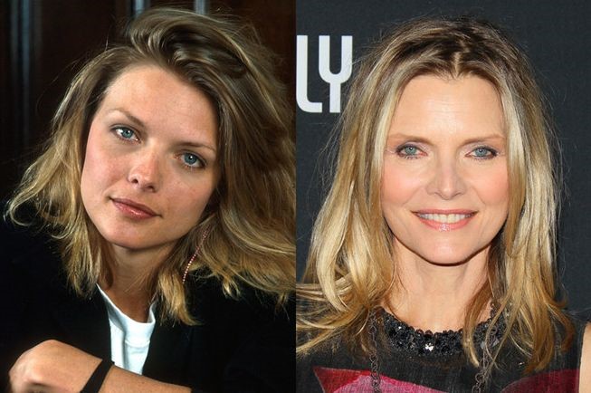 Michelle Pfeiffer before and after plastic surgery