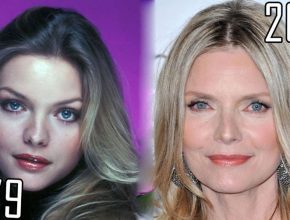 Michelle Pfeiffer before and after plastic surgery (9)