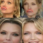 Michelle Pfeiffer plastic surgery (17)