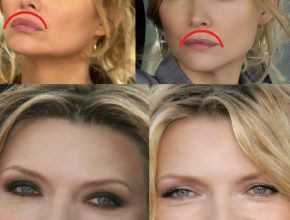 Michelle Pfeiffer plastic surgery (17)