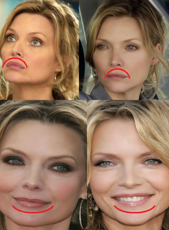 Michelle Pfeiffer Plastic Surgery Celebrity Plastic Surgery Online