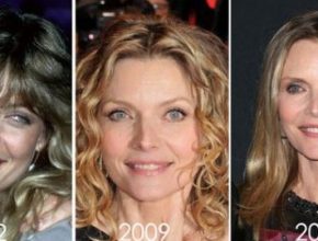 Michelle Pfeiffer plastic surgery 1982 - 2012