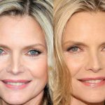 Michelle Pfeiffer plastic surgery (23)