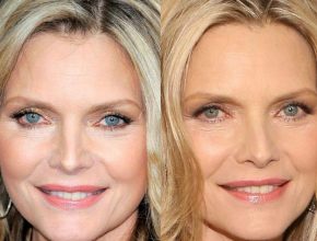 Michelle Pfeiffer plastic surgery (23)