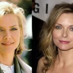 Michelle Pfeiffer plastic surgery (27)