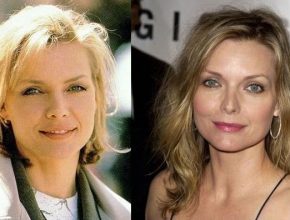 Michelle Pfeiffer plastic surgery (27)