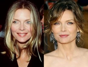Michelle Pfeiffer plastic surgery (7)