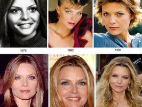 Michelle Pfeiffer plastic surgery from 1975 to 2009