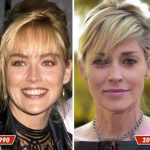 Sharon Stone before and after plastic surgery (2)