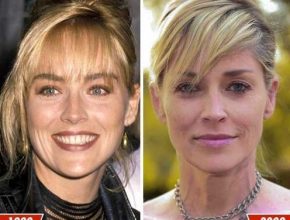 Sharon Stone before and after plastic surgery (2)
