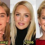 Sharon Stone before and after plastic surgery (28)