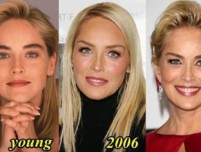 Sharon Stone before and after plastic surgery (28)