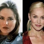 Sharon Stone before and after plastic surgery (32)