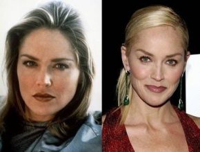 Sharon Stone before and after plastic surgery (32)