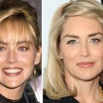 Sharon Stone before and after plastic surgery (34)