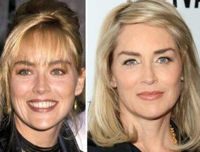 Sharon Stone before and after plastic surgery (34)