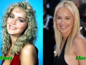 Sharon Stone before and after plastic surgery (35)